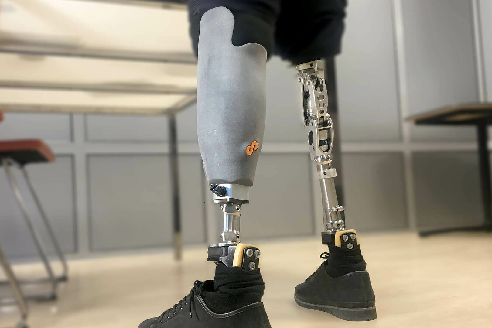 Prosthetic Socket