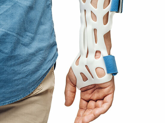 The right hand of a white male wearing a denim shirt with white 3d printed orthotics held together with BASF blue Velcro straps.